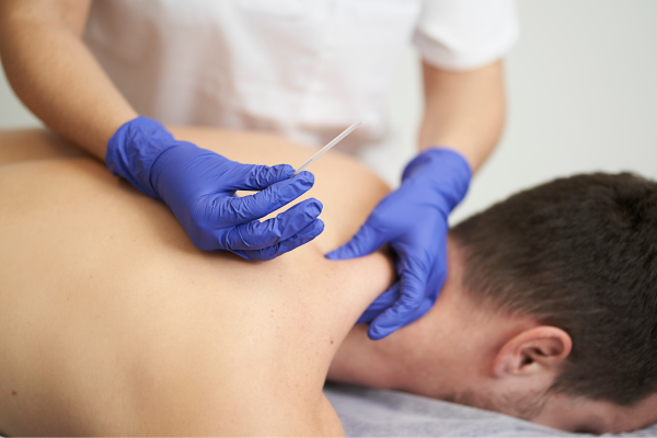Dry Needling Therapy In Gurgaon